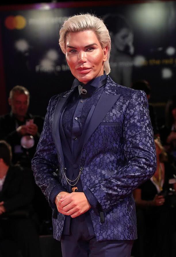 巴西男芭比娃娃,巴西整容狂人芭比娃娃