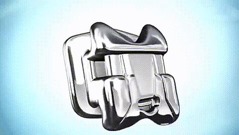 地包天戴牙套为什么牙套只戴上面,一个牙齿的牙套矫正的全过程