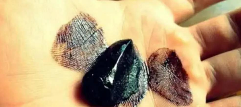 每年卖出1个亿,骗过14亿中国人:“印度神油”背后的罗生门