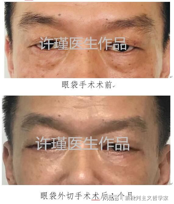 名医专访丨上海交通大学医学院附属同仁医院许瑾：面部美容整形