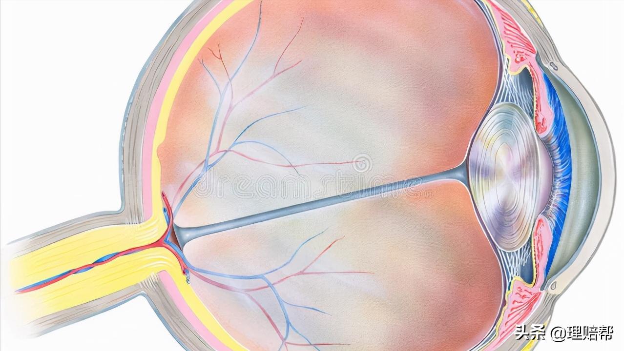 双目失明保险公司赔偿,双目失明保险理赔案例