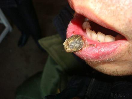 痣出现的位置真的重要吗,痣相大揭秘来看看吧