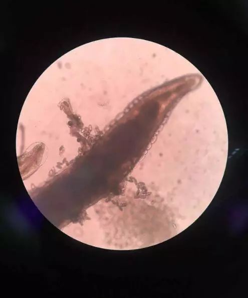 4岁女童屁屁痒，妈妈检查后吓坏了！一粒粒竟还会动...