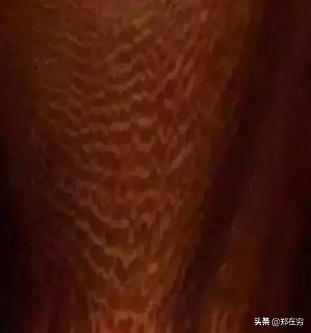 六种常用木材,常见的十种木材