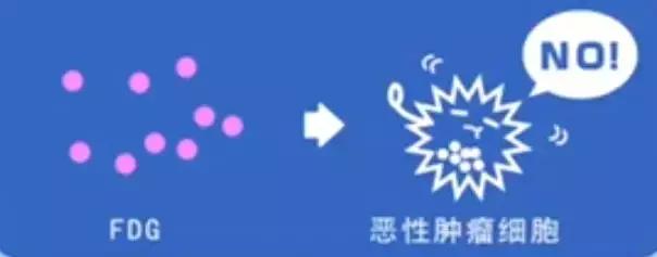 外国早期筛查癌症,petct用于诊断癌症