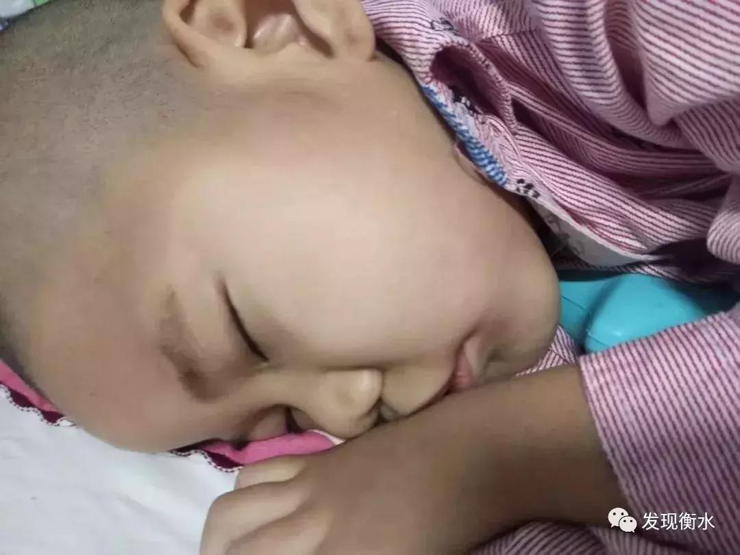 4岁小天使遗体捐赠,捐献眼角膜的小天使