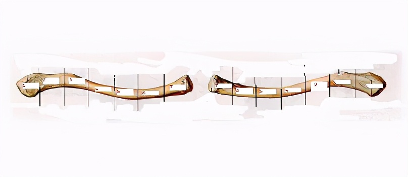 李振华治疗颈椎病,颈椎病治疗专家李国民