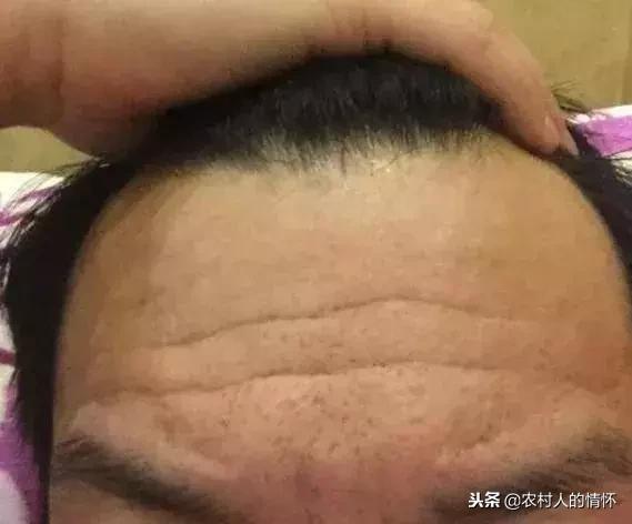 看额头三才纹知命运图解,男人额头有纹和地纹代表什么意思