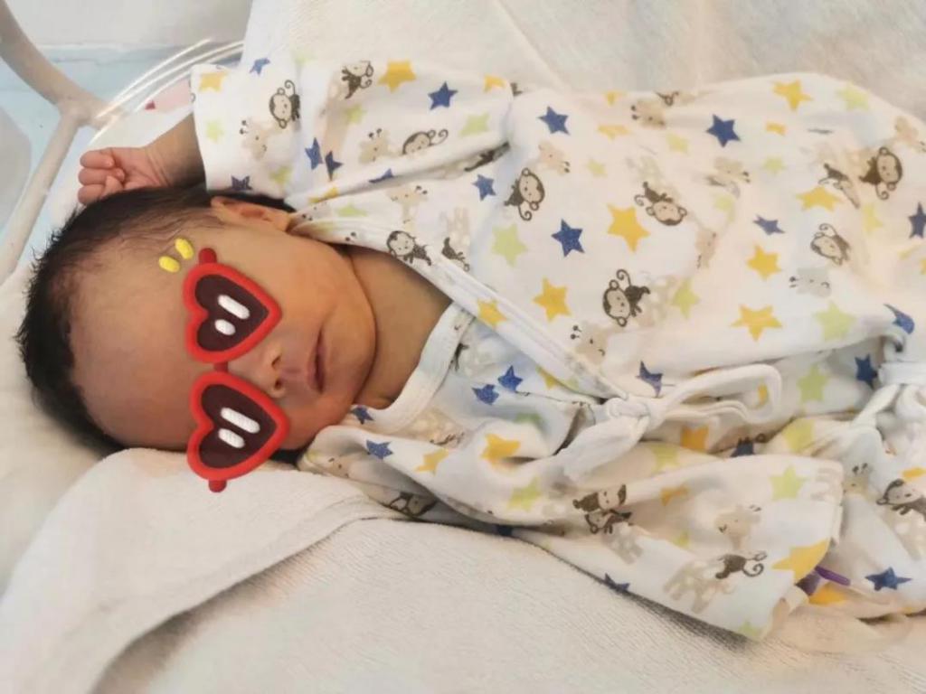 熊猫血孕期怎么监护胎儿情况,熊猫血孕妇剖腹产大出血几率