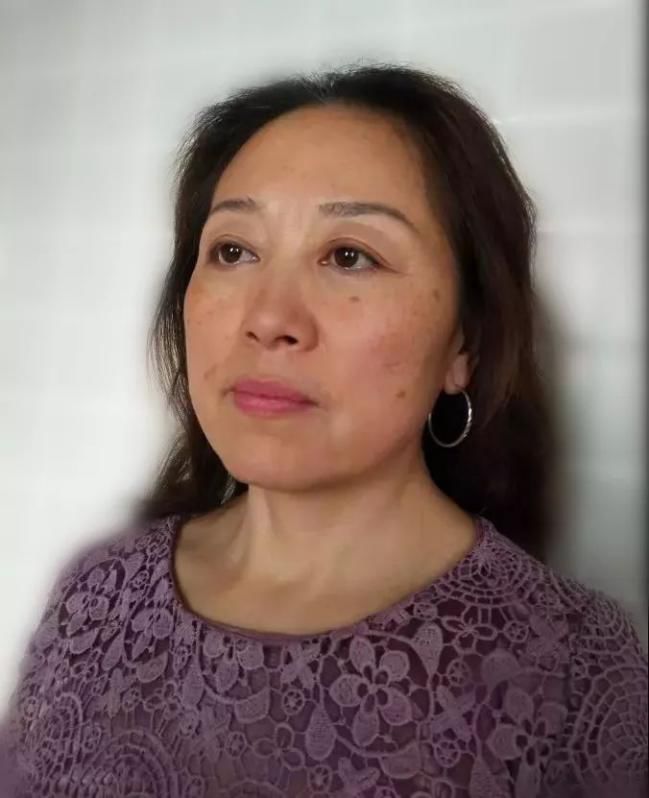 除皱小妙招,真性皱纹最快的除皱方法