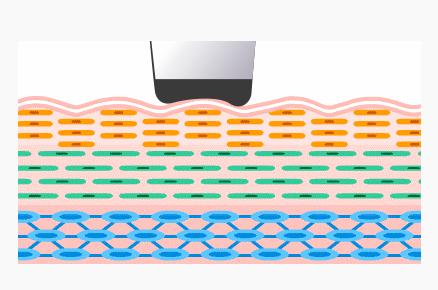 自嘲整容,承认整容七年的姐姐