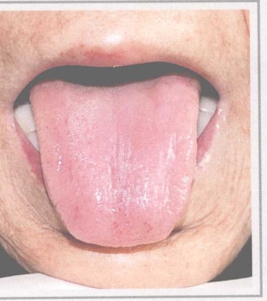 从舌头看身体状况拍照,如何看舌头判断孩子身体状况