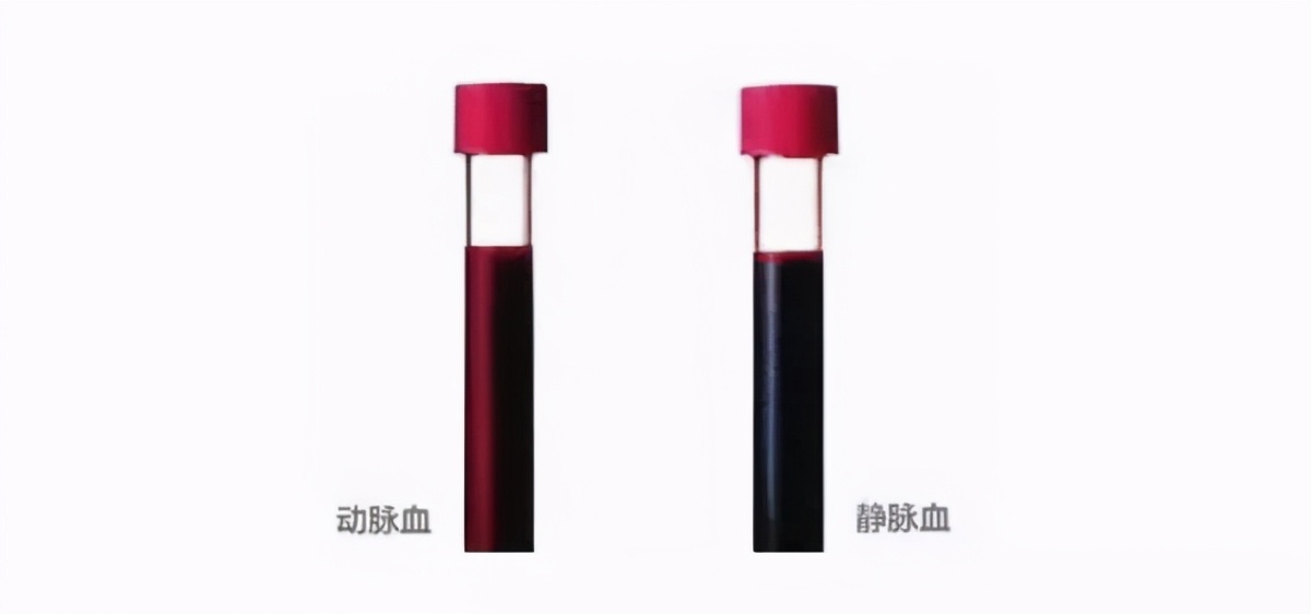 换血能不能保持年轻,换血能年轻