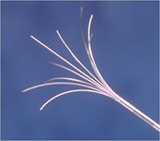 肝癌未转移手术切除后会再复发吗,肝癌肝移植后复发和转移哪个严重