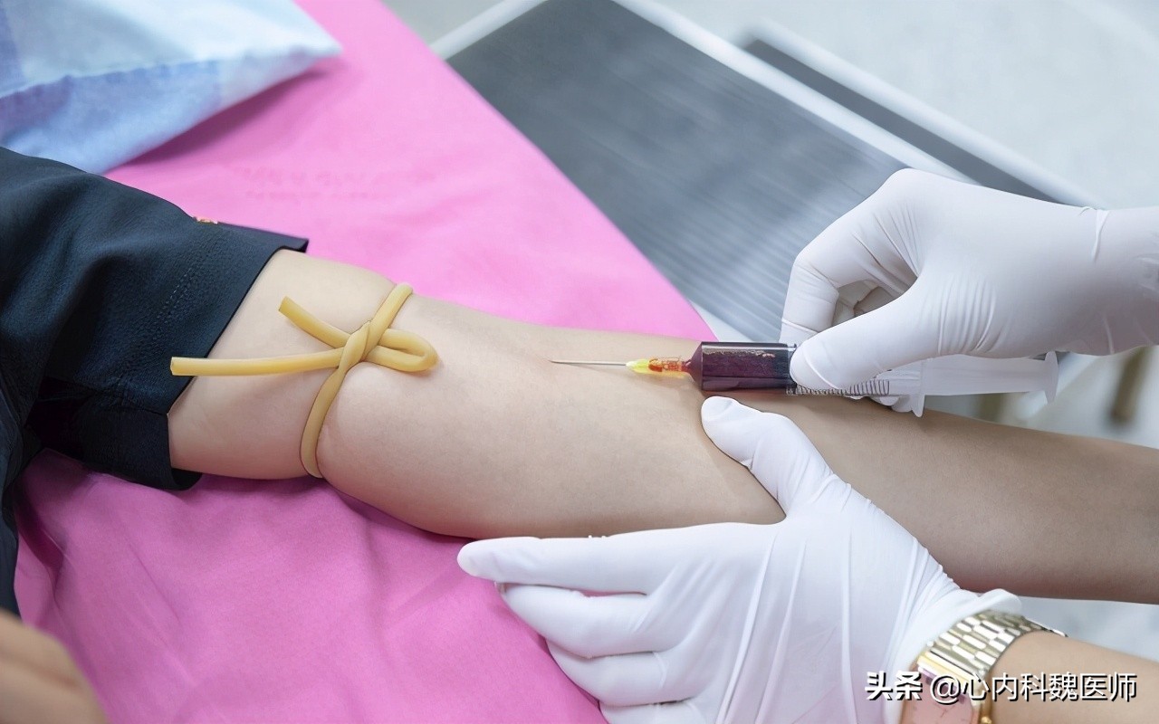 他汀类药物如何克服肌肉酸痛,他汀肌肉痛怎么办