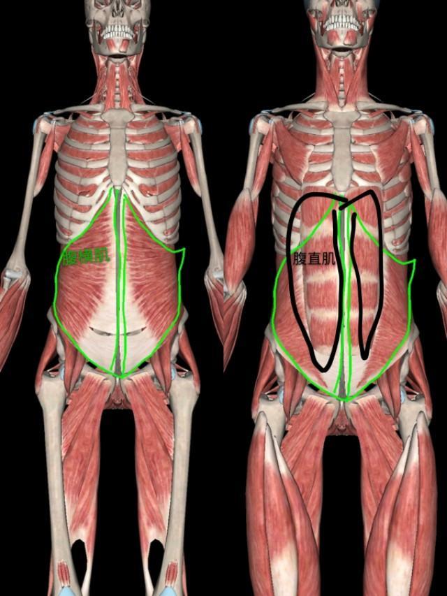 肚子不大就是很松弛怎么办,宝妈腹部松弛下垂可以手术吗