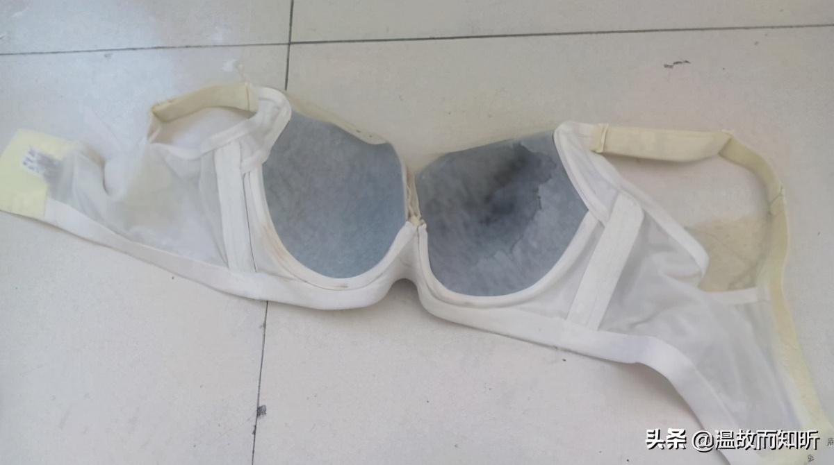 “不期而至”的乳头溢液，我该爱你还是恨你？