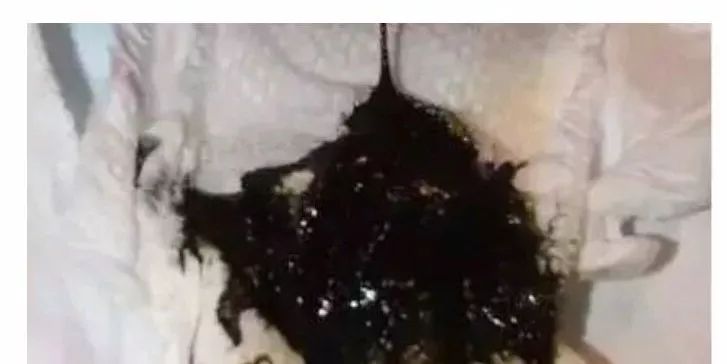 大便正常说明肠道健康吗,宝宝正常大便应该是什么样