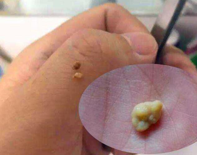 孩子被嫌弃太臭家长带去医院检查,儿子被同学嫌弃