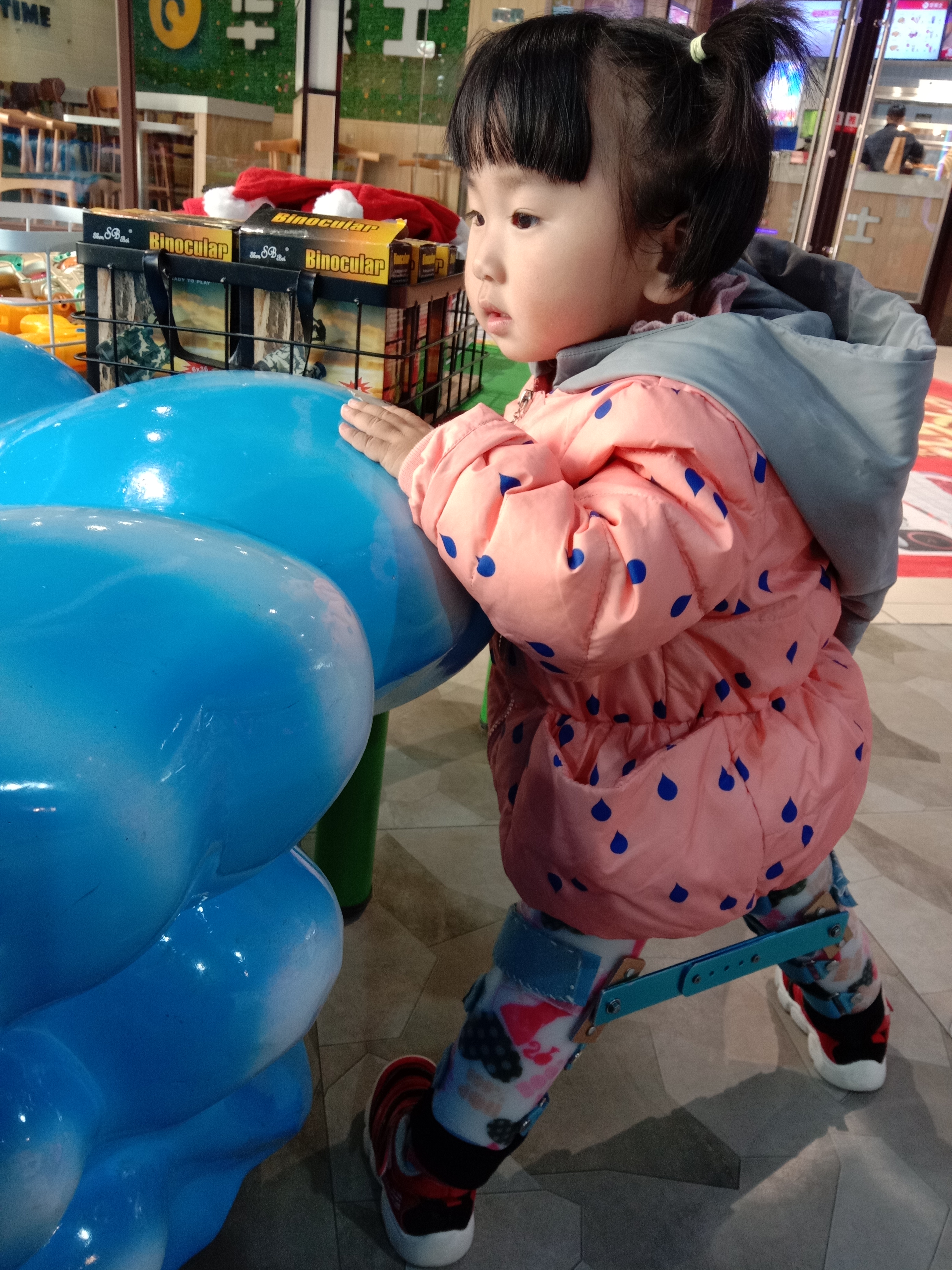 小儿先髋步态,先髋患者的自我治疗康复经历