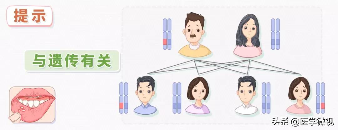 口腔溃疡引起淋巴结一般多久自愈,口腔溃疡的自愈和白细胞有关系吗