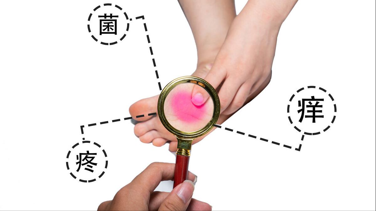 脚上痒痒一挠就起水泡是怎么回事,脚上痒痒的有小疙瘩红红的怎么办