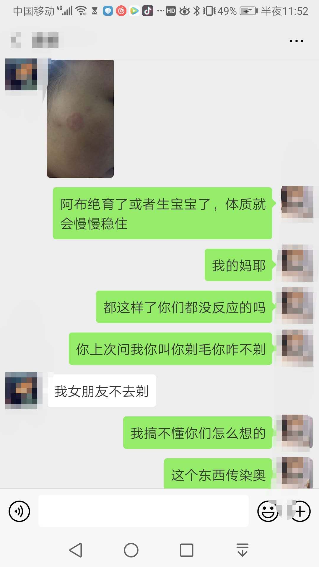 贪便宜买的猫,无良商家猫癣家里的猫全部中招