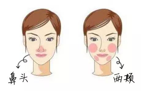 严重的红血丝泛红怎么治疗,红血丝泛红是因为什么