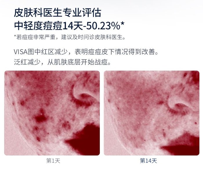 女生最爱的礼物排行榜,送男朋友油痘肌护肤品推荐