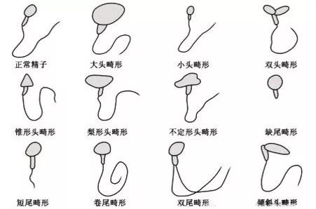 怎么才是赢在起跑线上,怎样才能输在起跑线上