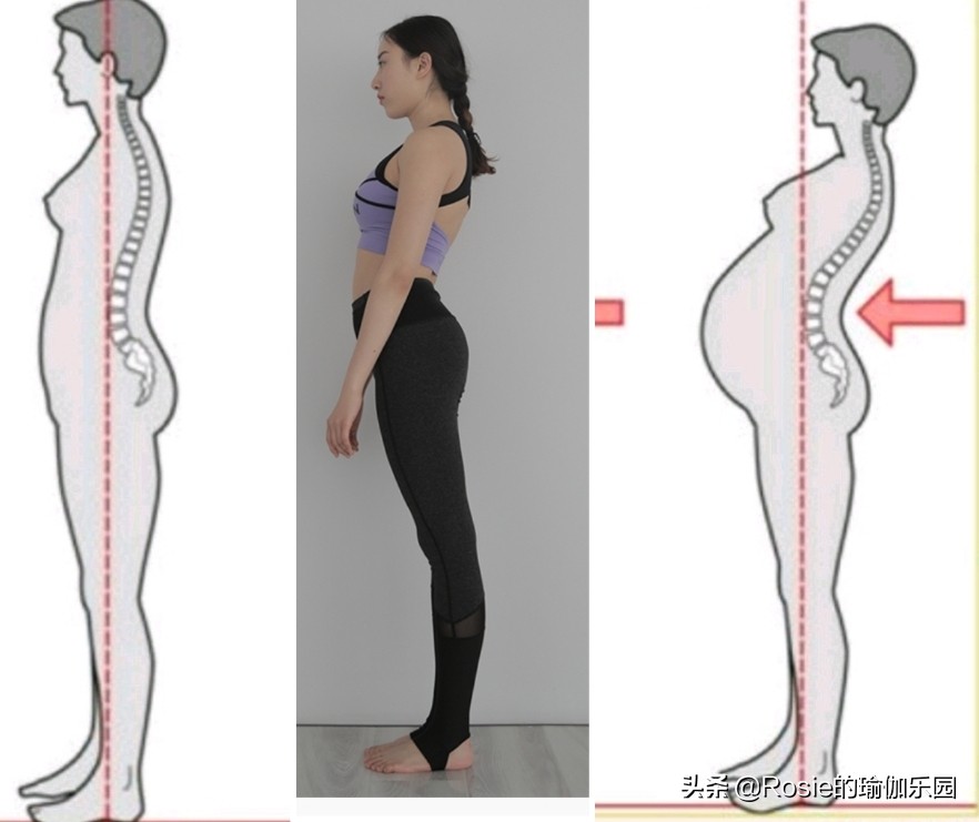 一个动作判断你是不是翘臀,你以为的翘臀很可能是骨盆前倾