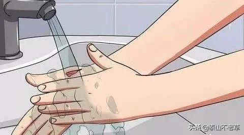 受伤皮试不能打破伤风针怎么办,鼻子受伤大出血要打破伤风针吗