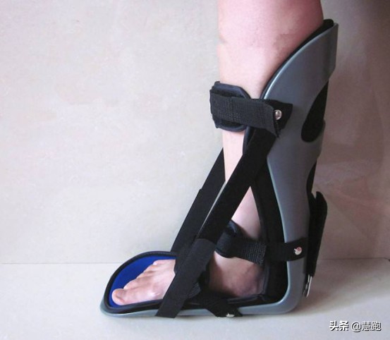 治疗足底筋膜炎最好的方法,足底筋膜炎治疗的正确方法