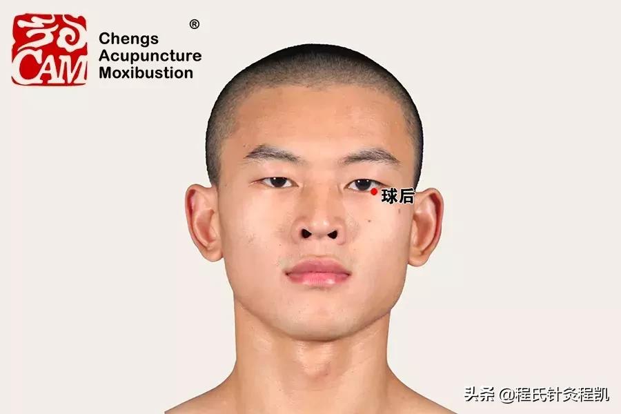 针灸治疗黄斑病变,视网膜黄斑变性的针灸治疗