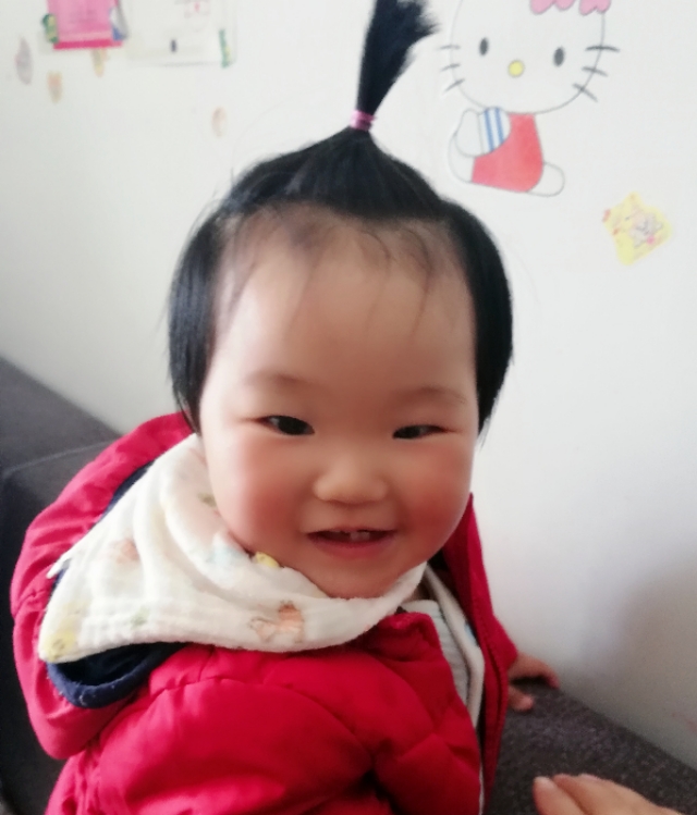 便秘严重需要动手术吗,一岁宝宝长期便秘需要检查什么