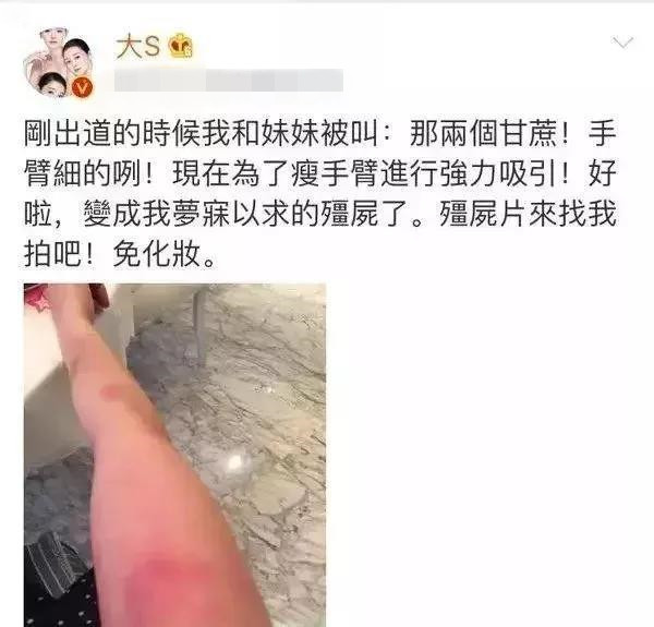 大s吃抗凝血剂美白,大s自曝为了美白曾吃过抗凝血剂