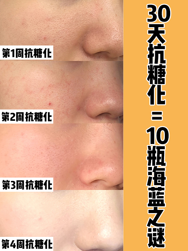 坚持抗氧化会变白吗,坚持20天抗氧真的能变白吗