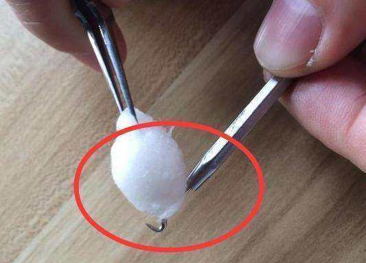 眼角有脂肪粒怎么祛除,眼角有脂肪粒怎么去掉