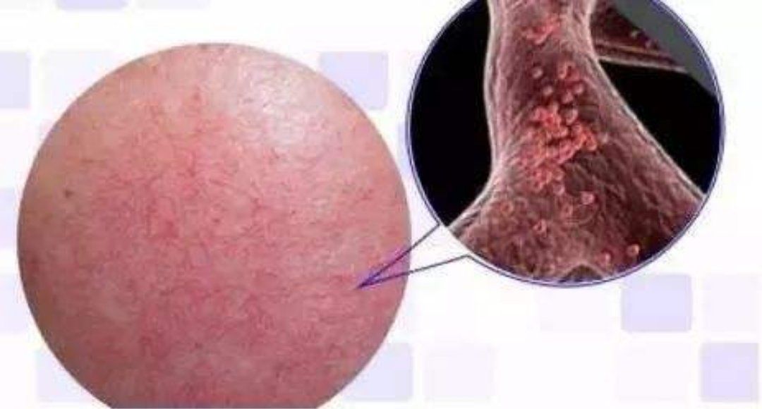 脸皮还是“厚点”好，全方位解决*血丝红**