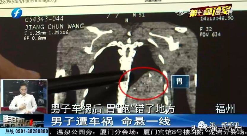 男子被车撞飞十几米身亡,一名男子被车撞飞40米后活了下来