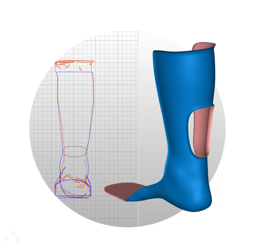孩子足外翻买什么鞋矫正,儿童足外翻矫正鞋去哪里做