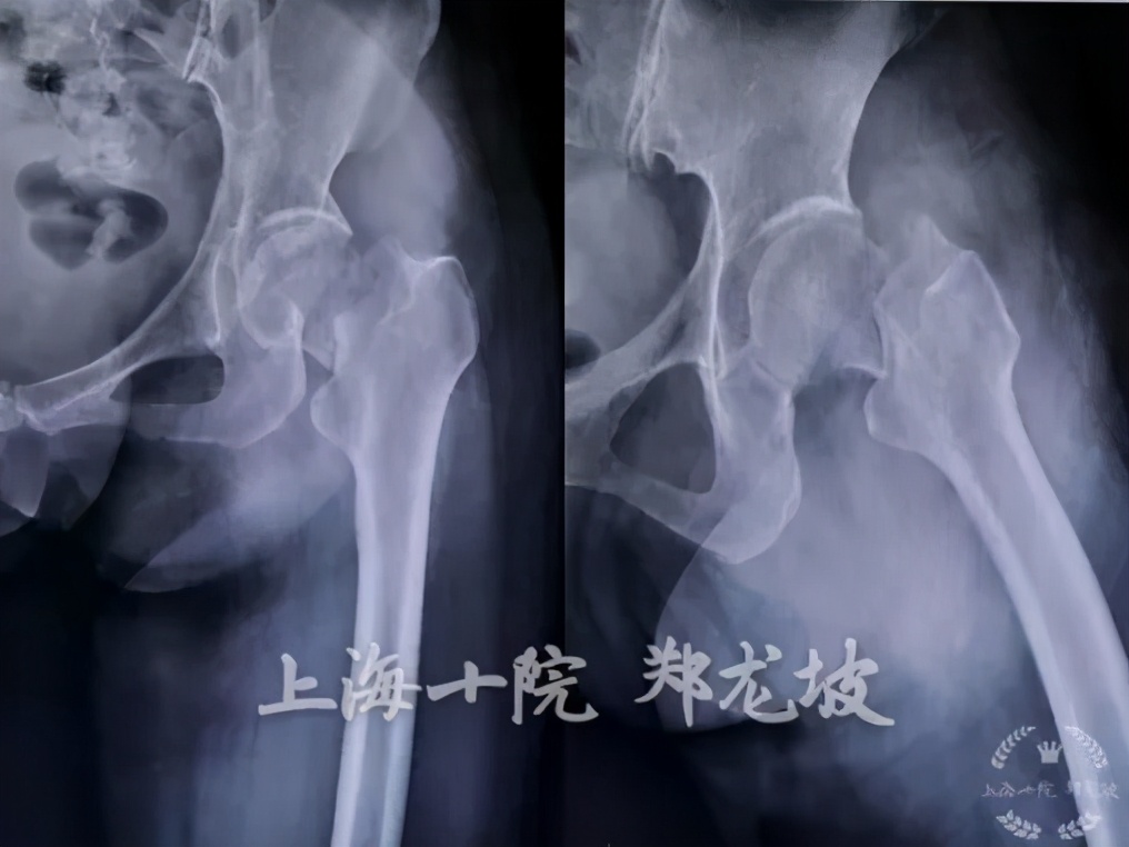 上海十院骨科手术量,上海骨科手术机器人