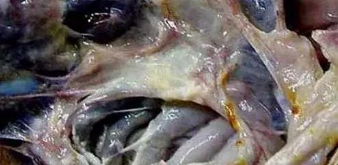 气囊炎四天自愈方法,气囊炎如何防治