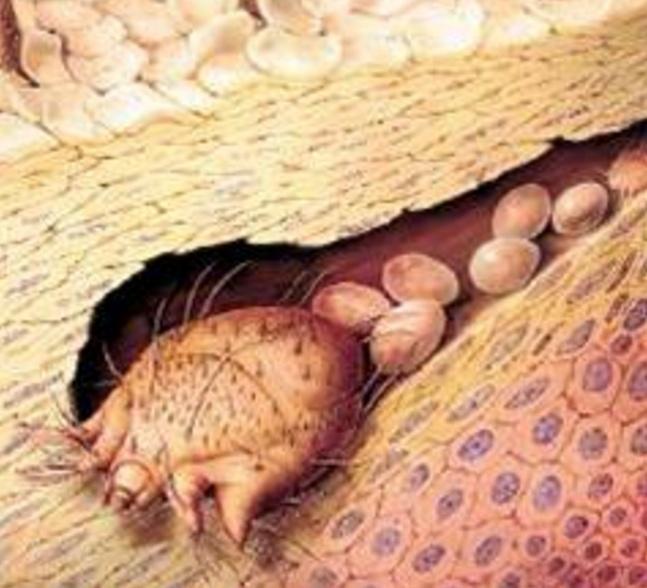 脸颊一直长痘痘闭口粉刺怎么办,脸颊长痘痘什么原因导致