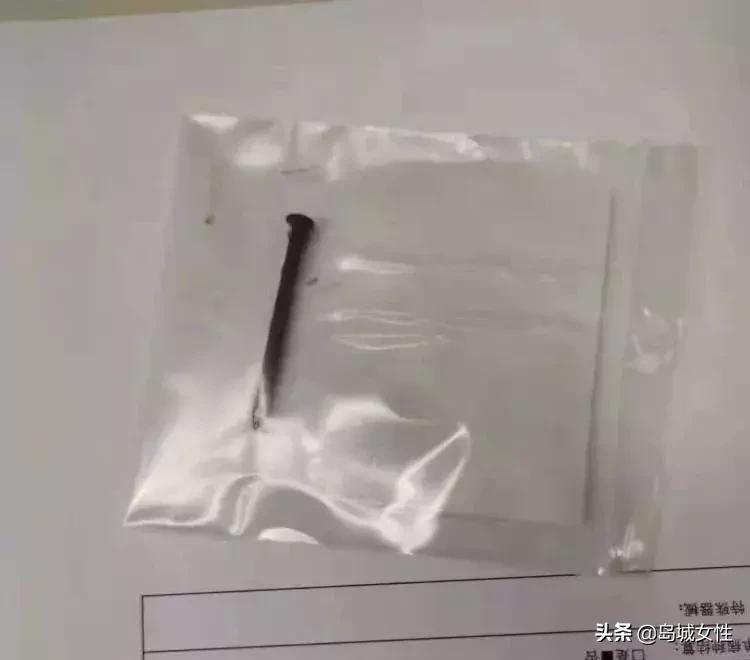 8岁男孩误吞5厘米钢钉,惊险9岁男孩误吞3厘米图钉