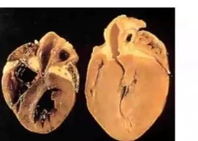 猫咪肥厚型心肌病推荐药,猫得了hcm肥厚型心肌病