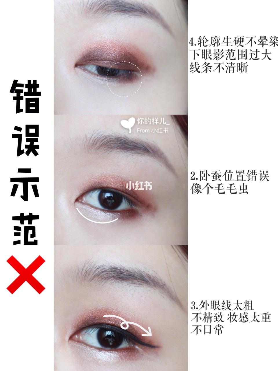 肿眼泡内双怎样贴出宽大双眼皮,肿眼泡内双眼皮怎么整形