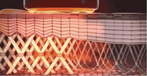 切眼袋会加速衰老的案例,割双眼皮衰老更快