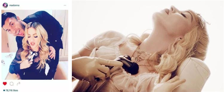 杨幂做了什么医美,杨幂新氧医美