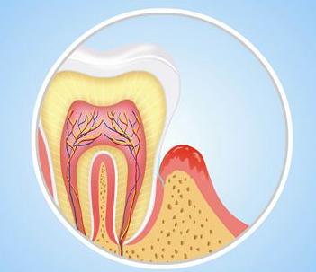 孩子牙痛要怎么解决,小朋友牙痛的原因有哪些呢